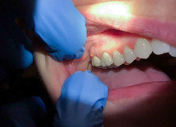 Best Weekend Emergency Dental Services in Myersville, MD